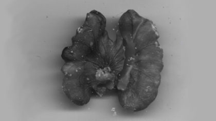 doubled up, still: Scan of a walnut. I really enjoyed doing this sequence. I used lots of scanned nuts to mimic the grainy, surreal look of the image you see whilst the foetuses are being scanned with ultrasound.