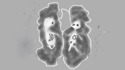 doubled up, still: Scary skeleton foetuses – you really can see their skulls and inside their bodies during the scans. Multiple pregnancies have to have lots of scans as the normal blood tests done on singletons don’t work.