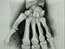 An Anatomy of Melancholy, still 8