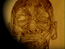 An Anatomy of Melancholy, still 20
