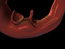 Kingdom Protista, still 2