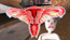 Sucked Up, still 2: fallopian moth